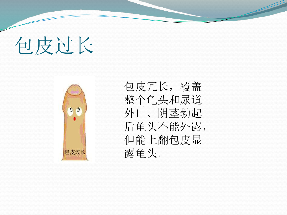 包茎包皮过长教学课件.ppt_第3页