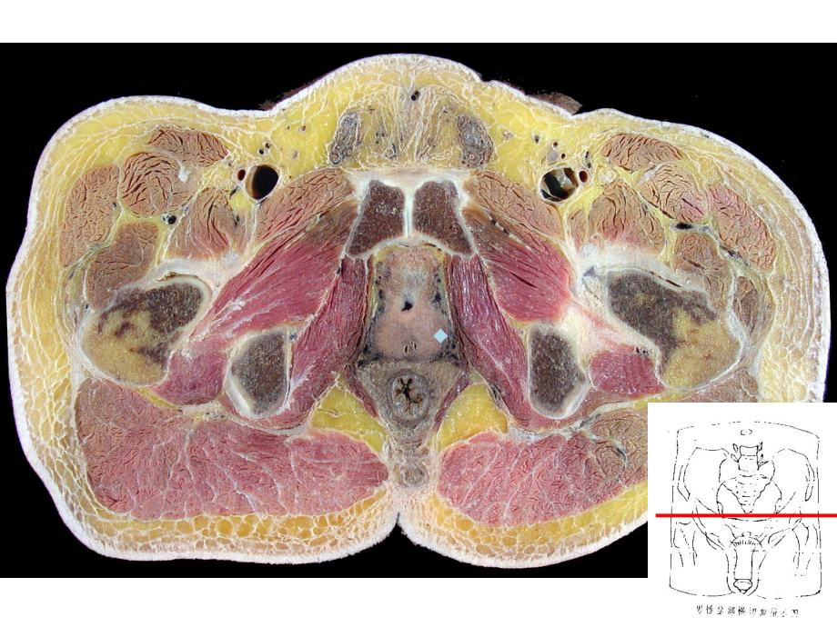人体断面与影像解剖学盆部与会阴之二课件.ppt_第1页