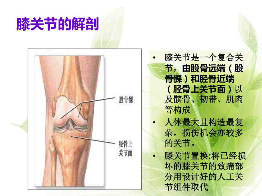 人工全膝关节置换术后护理课件-参考.ppt_第2页