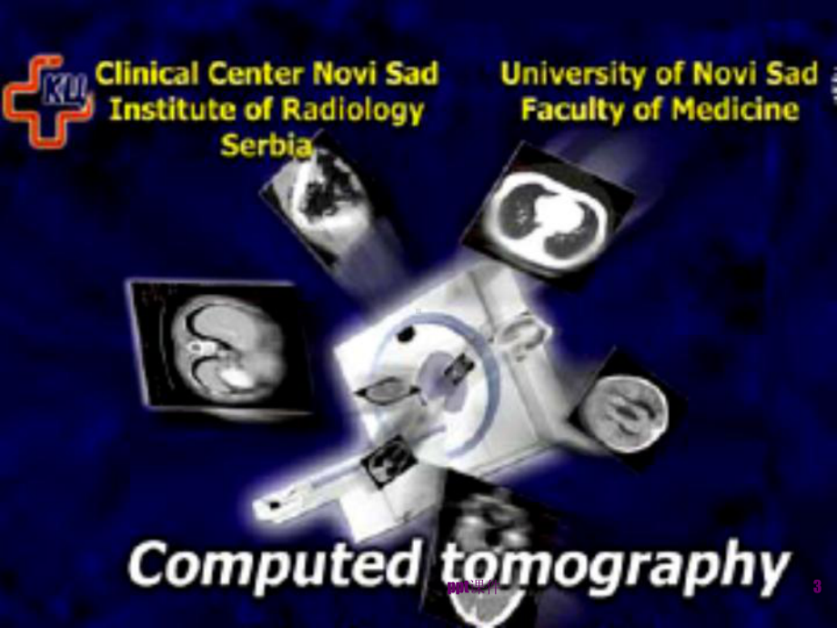 医学影像技术学-CT-课件.ppt_第3页