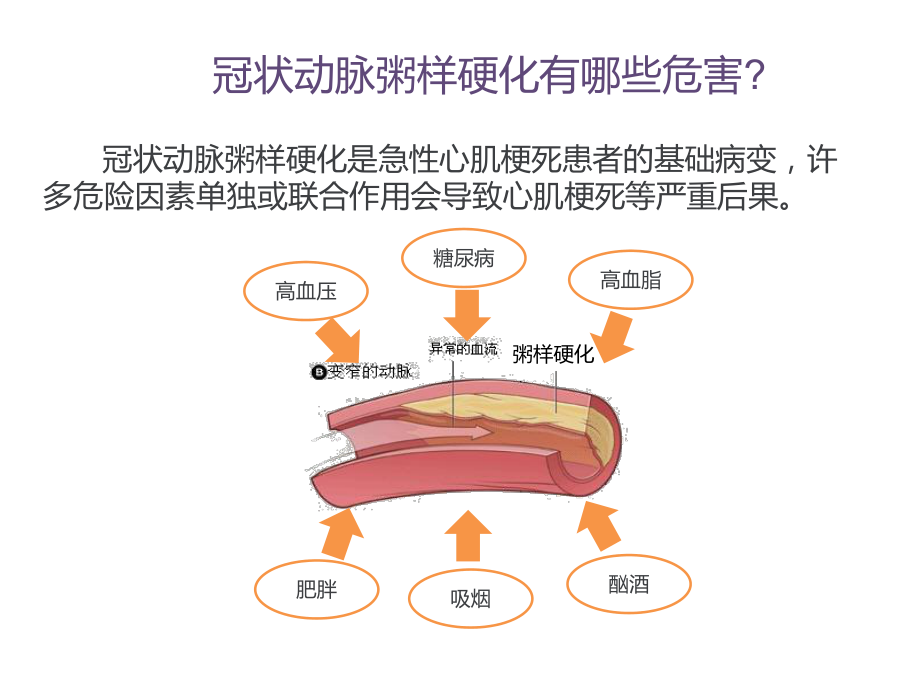 冠心病患者如何改善生活方式课件.ppt_第2页