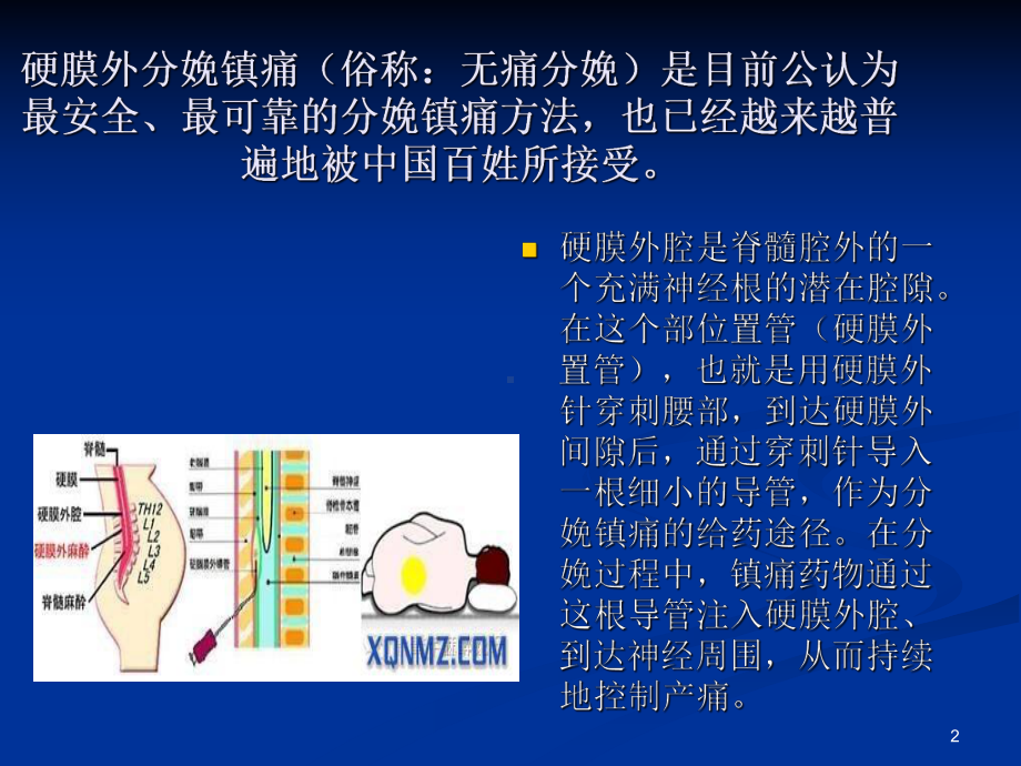 产后腰痛课件.ppt_第2页