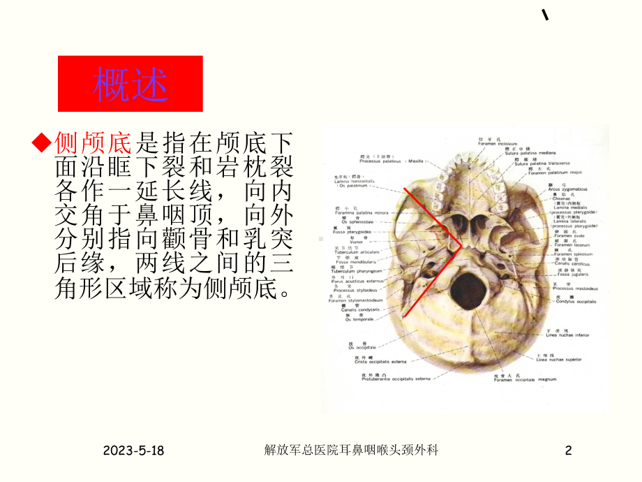 侧颅底解剖课件.ppt_第2页