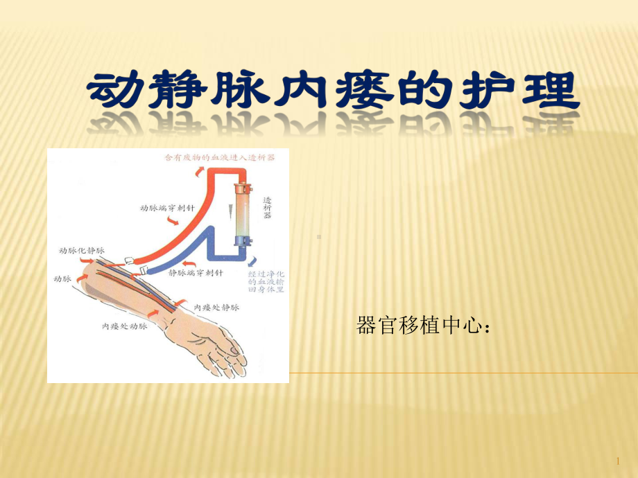 动静脉内瘘的护理查房课件.ppt_第1页