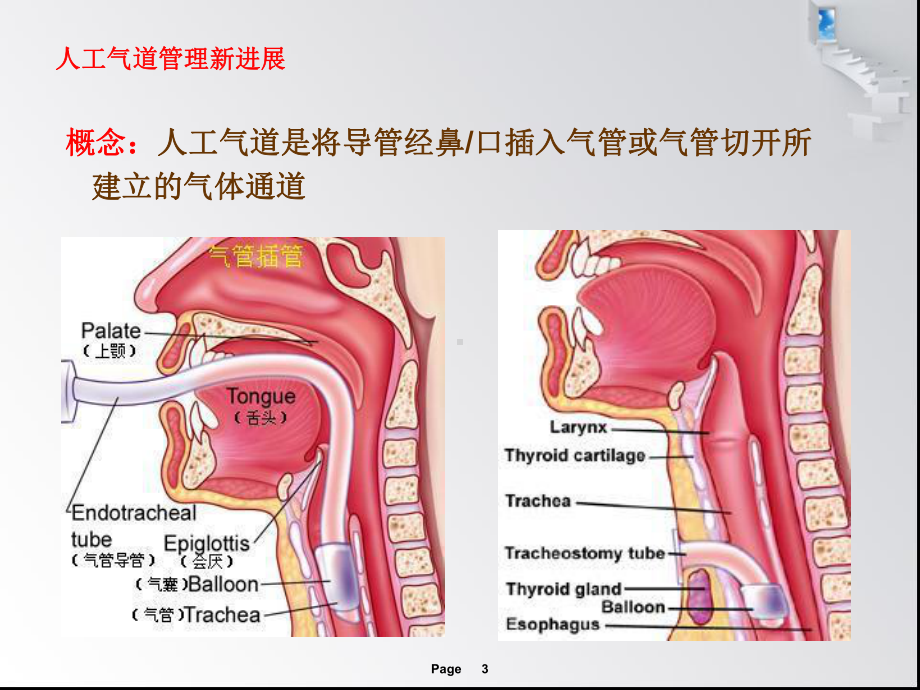 人工气道管理新进展-课件.ppt_第3页