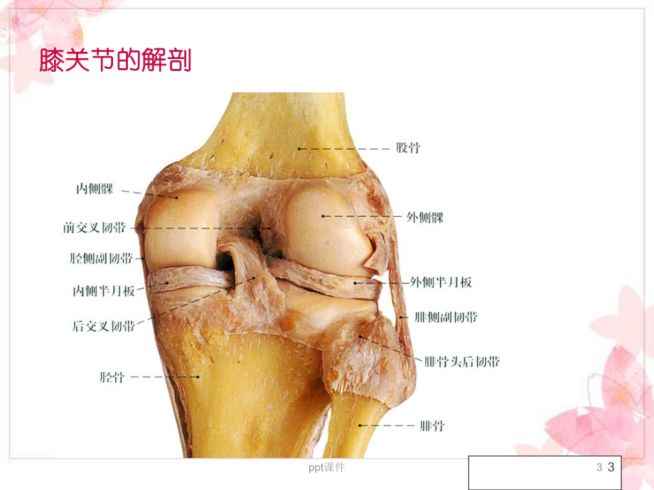 人工膝关节置换术的护理-课件.ppt_第3页