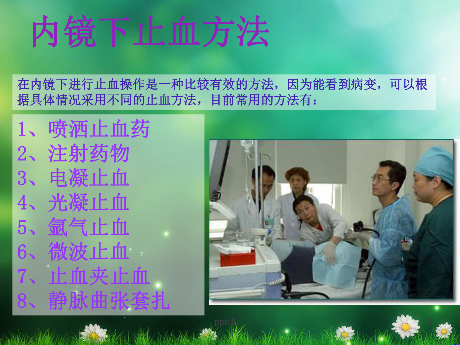 内镜下止血治疗业务学习-课件.ppt_第3页