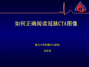 冠脉CTA读片(非常经典)课件.ppt