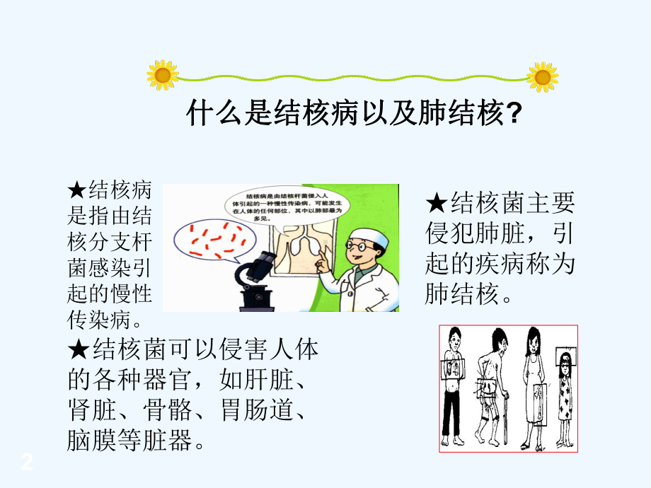 学生结核病防治知识宣传(中小学)-课件.ppt_第2页