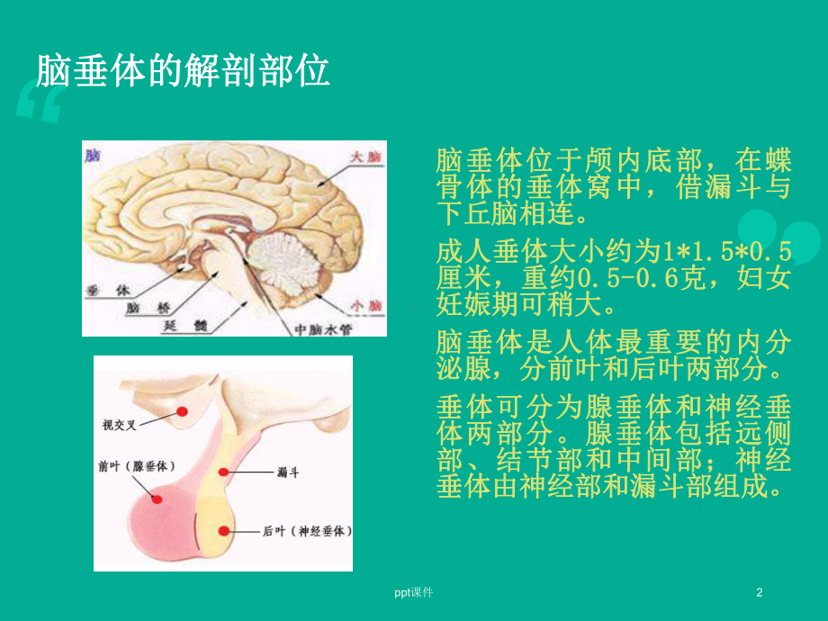 垂体瘤的围手术期护理-课件.ppt_第2页