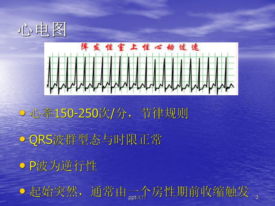 室上性心动过速的护理-课件.ppt_第3页