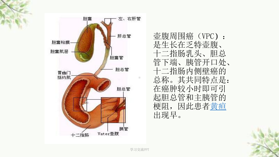 壶腹周围癌课件.ppt_第2页