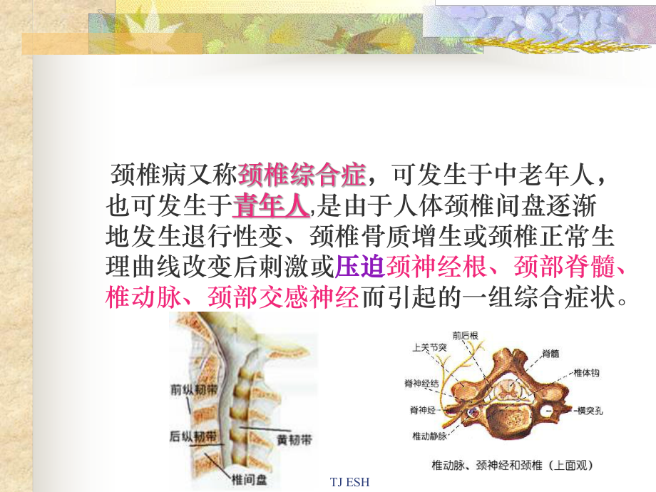 如何预防颈椎病课件.ppt_第2页