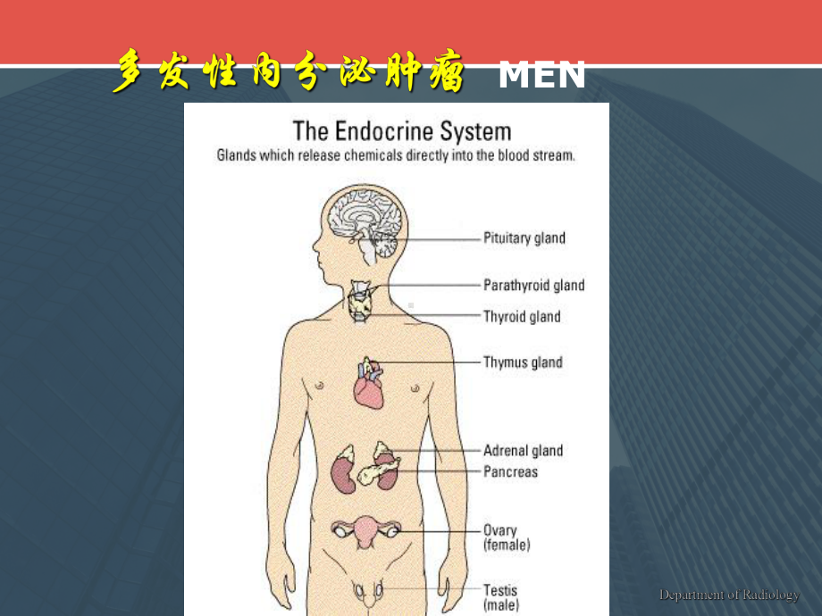 多发性内分泌肿瘤-课件.ppt_第3页