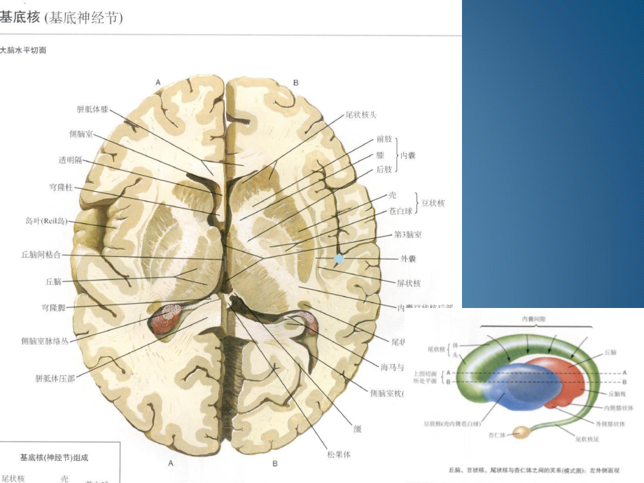 基底节区丘脑区对称性病变总结归纳课件.ppt_第2页