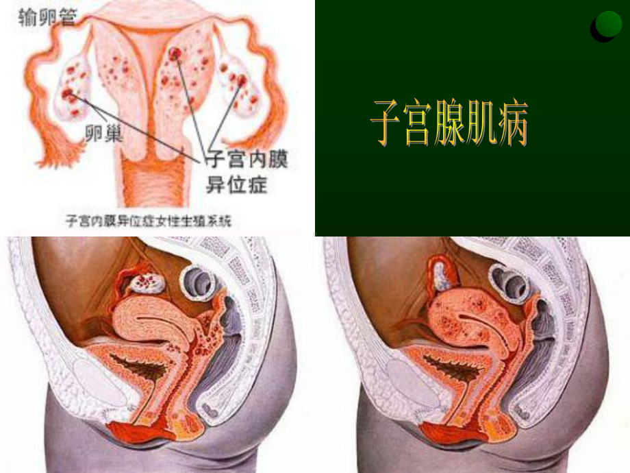 妇科护理查房课件(同名514).ppt_第3页