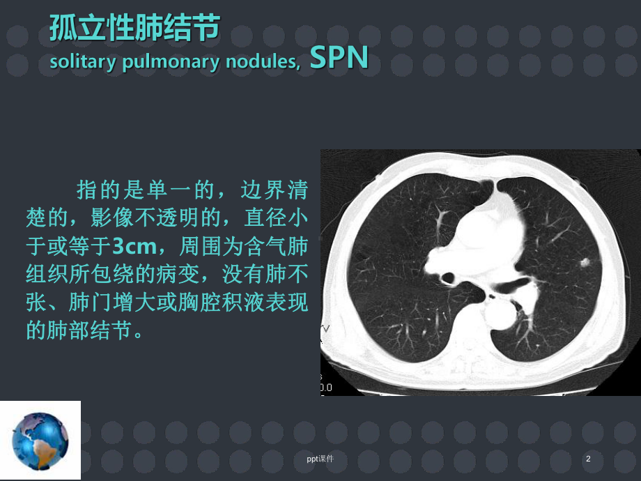 孤立性肺结节的诊断和治疗-课件.ppt_第2页