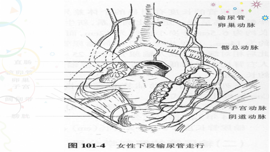 妇科手术中的泌尿系统损伤-课件.ppt_第3页