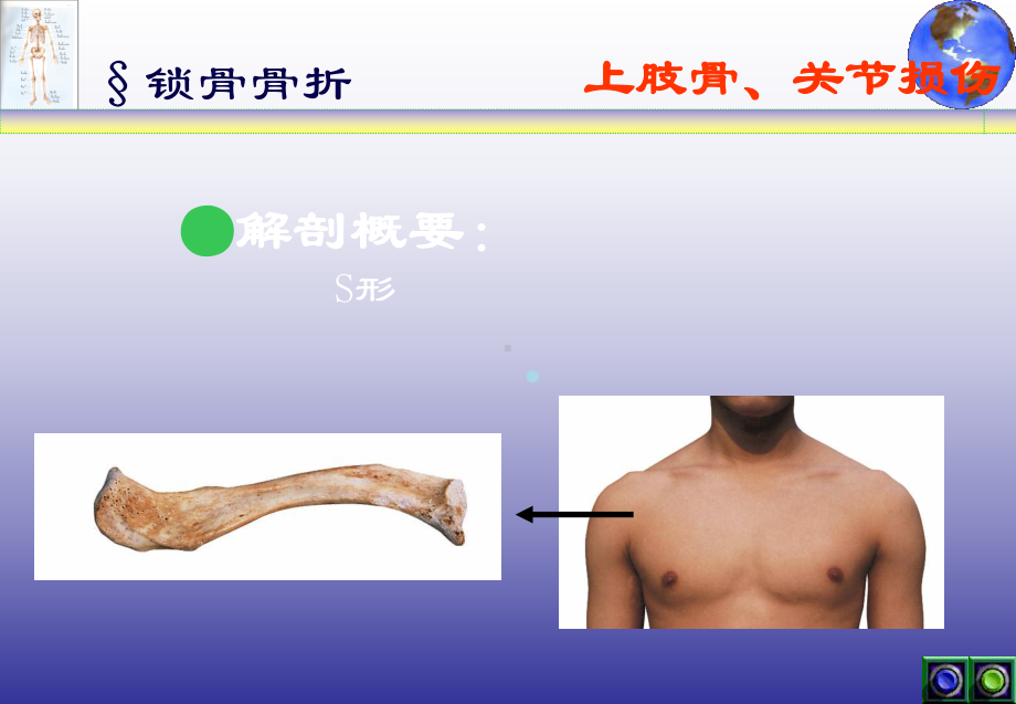 外科学课件上肢骨与关节损伤.ppt_第3页