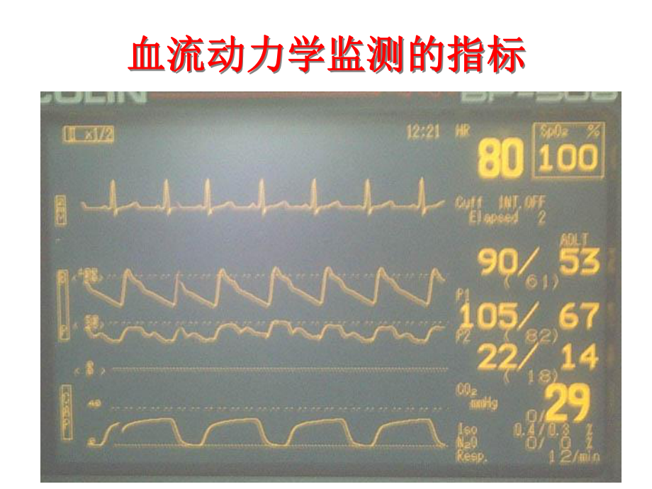 危重患者血流动力监测和管理课件.ppt_第2页