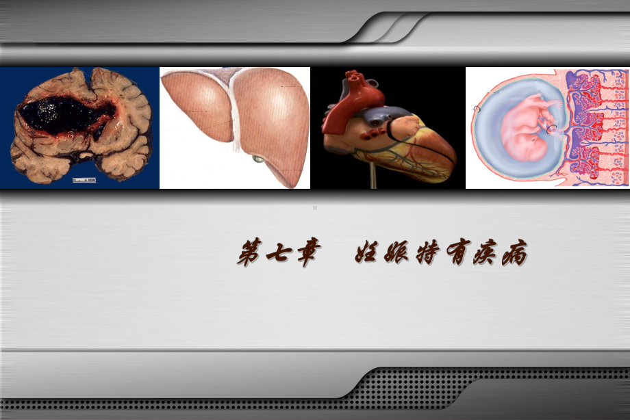 妊娠期糖尿病课件(同名517).ppt_第3页