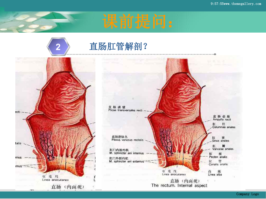 外科痔疮病人的护理刘宏佳教学课件.ppt_第3页