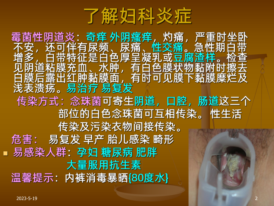 妇科疾病及炎症课件.ppt_第2页