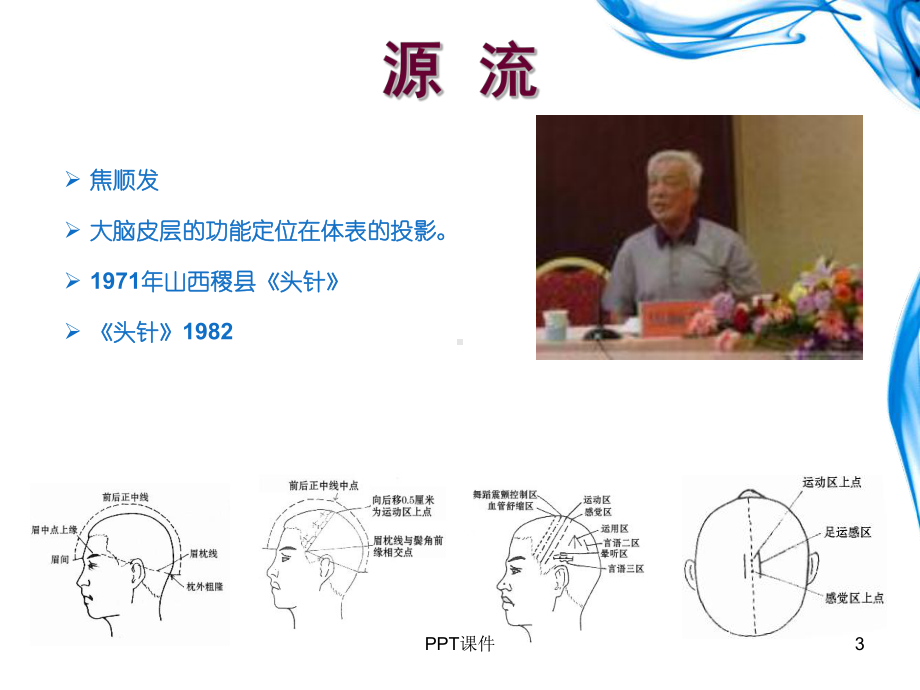 头针技术-课件.ppt_第3页