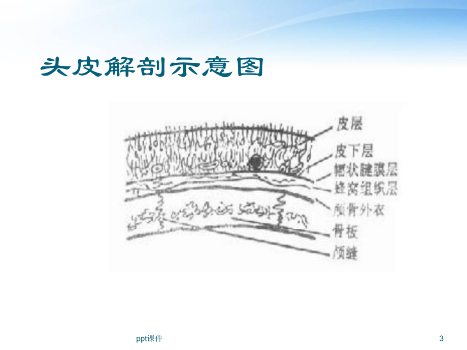 头皮损伤诊治课件.ppt_第3页