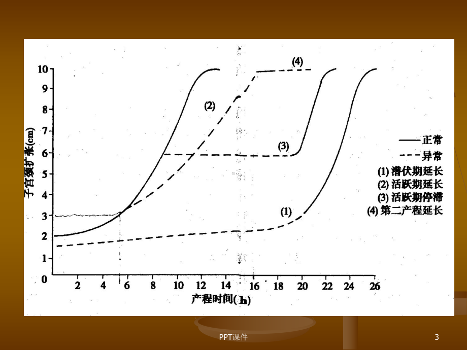 妇产科学异常分娩-课件.ppt_第3页