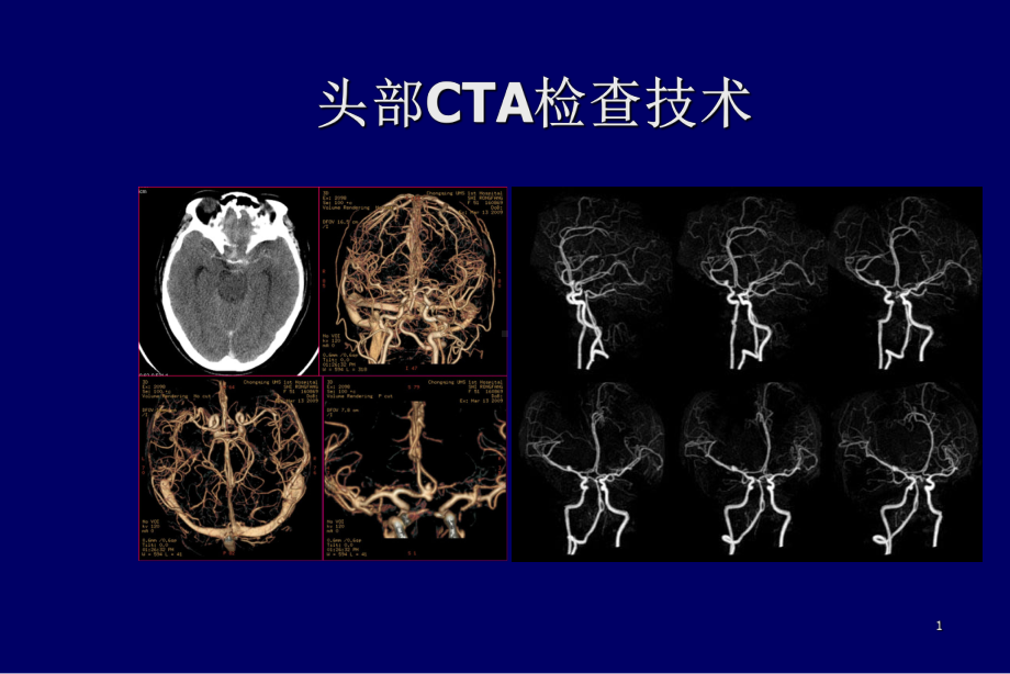 头部CTA检查技术课件.ppt_第1页