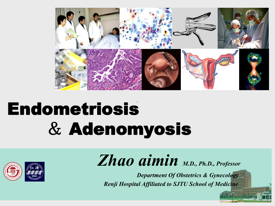 子宫内膜异位(Endometriosis)-赵爱课件.ppt_第1页