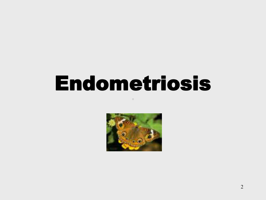 子宫内膜异位(Endometriosis)-赵爱课件.ppt_第2页