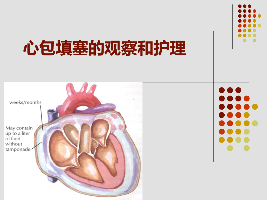 心包填塞的观察和护理-课件.ppt_第1页