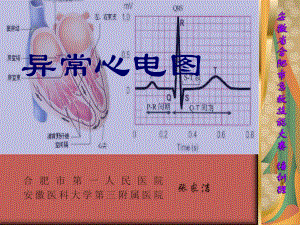 异常心电图11课件.pptx