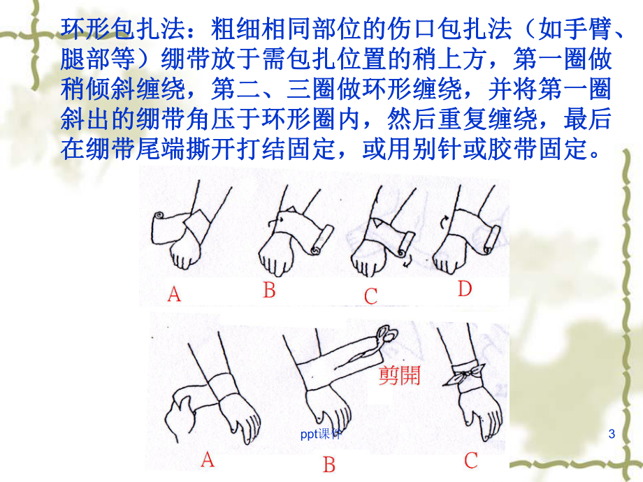 急救-包扎技术-课件.ppt_第3页