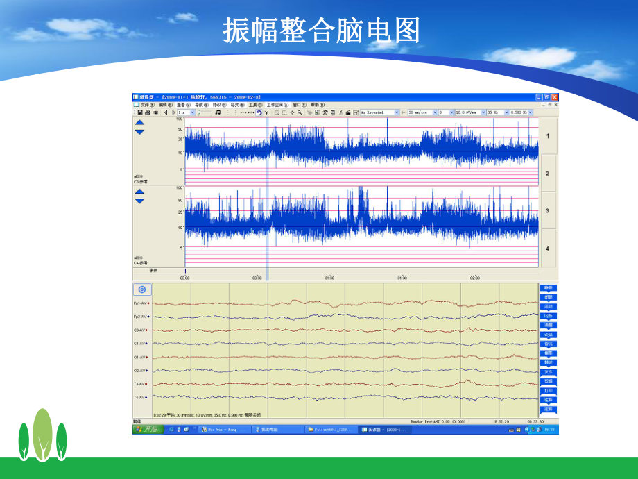 振幅整合脑电图在临床的应用课件.ppt_第3页