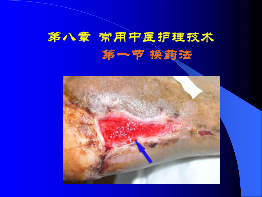 换药法、药熨疗法、熏蒸法课件.ppt_第1页