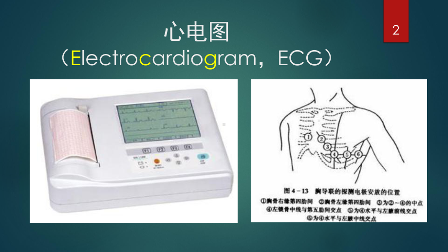 心电图学习(完整整理版)课件.pptx_第2页