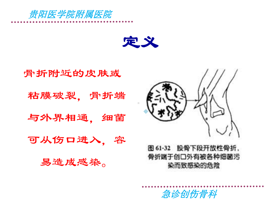 开放骨折-（课件）.ppt_第2页