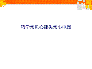 巧学常见心律失常心电图（心血管内科）-课课件.ppt