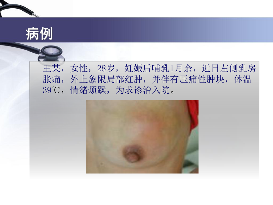 急性乳腺炎课件(同名579).ppt_第3页