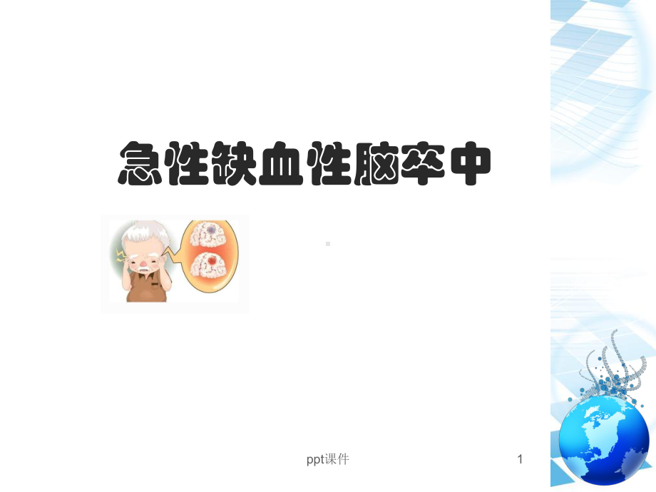 急性缺血性脑卒中的诊断和治疗-课件.ppt_第1页