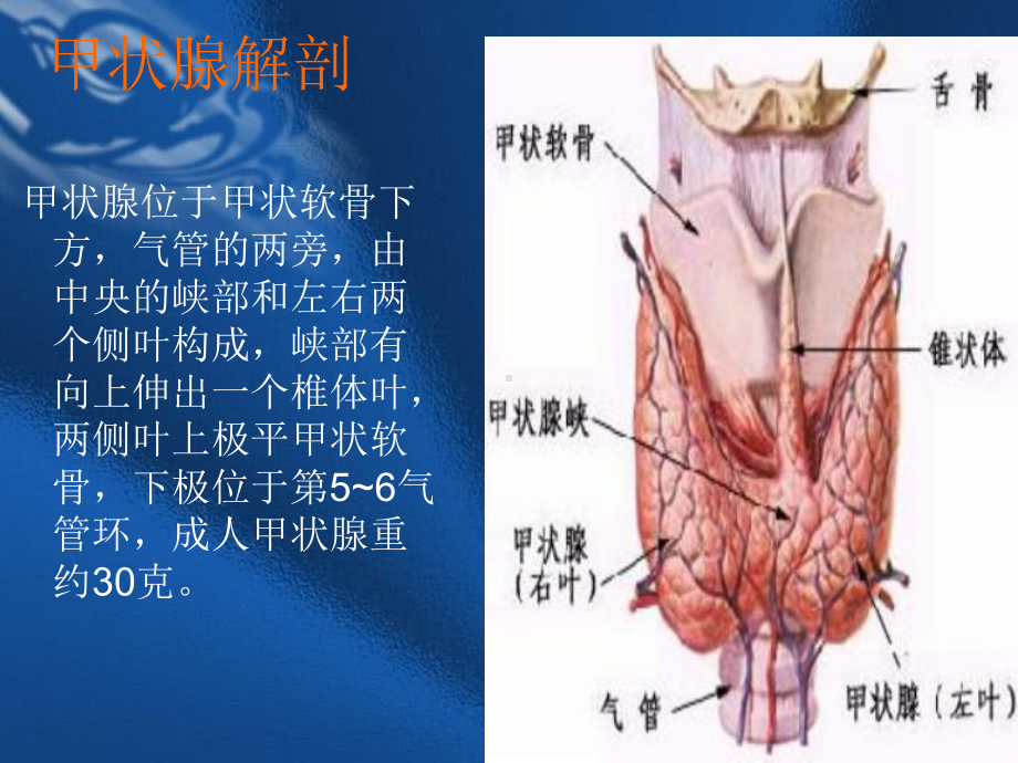 护理教学查房(甲状腺)@课件.ppt_第3页