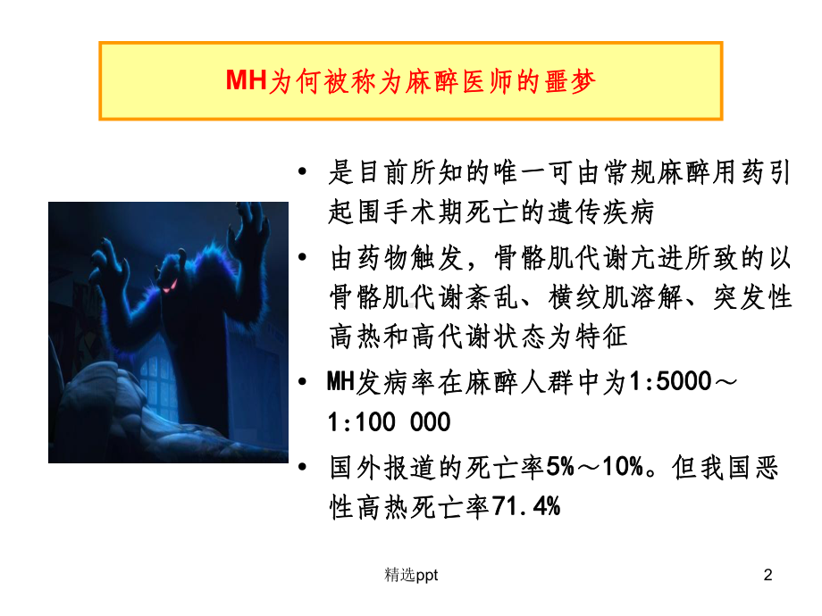 恶性高热(MH)课件.ppt_第2页