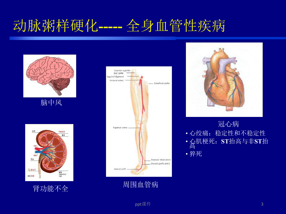 冠心病一二级预防-课件.ppt_第3页