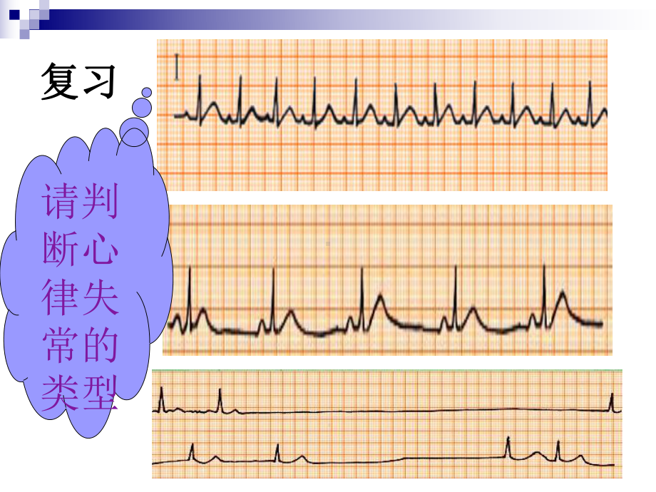 心律失常课件(同名561).ppt_第2页