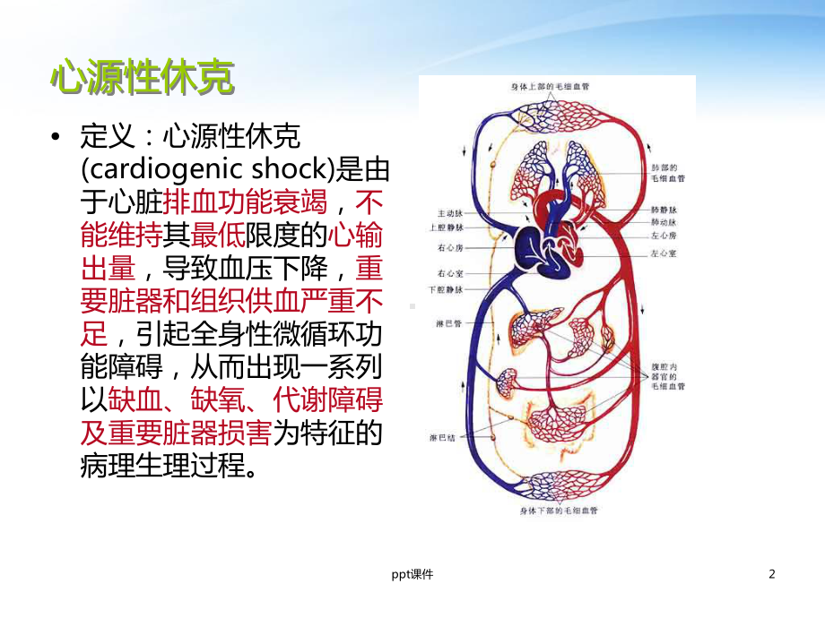 心源性休克的抢救配合-课件.ppt_第2页