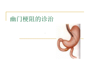 幽门梗阻的诊治课件.ppt