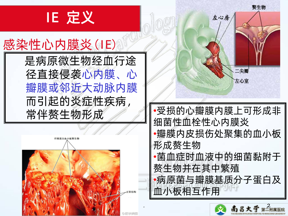 感染性心内膜炎指南课件.ppt_第2页